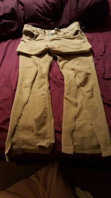 Hubs' trousers after being cut open by the paramedics 